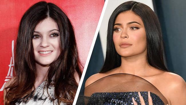 Kylie Jenner Story Fighting Anxiety, Health Issues & Body Stats