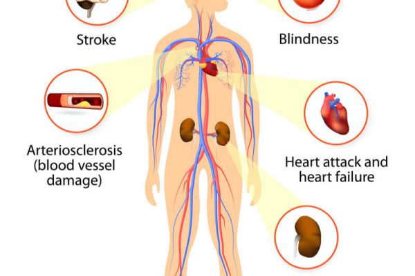 what-is-hypertension-and-how-does-it-affect-the-body-health-symptoms