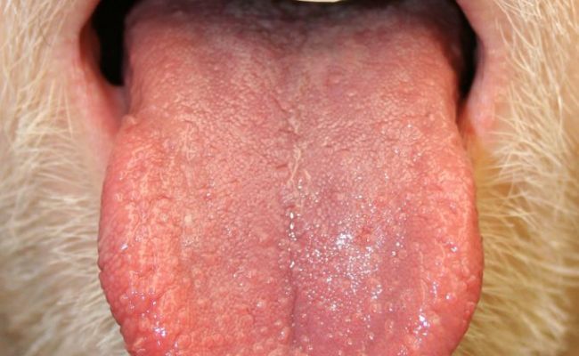 what-do-you-understand-by-tongue-bumps-what-causes-tongue-bumps